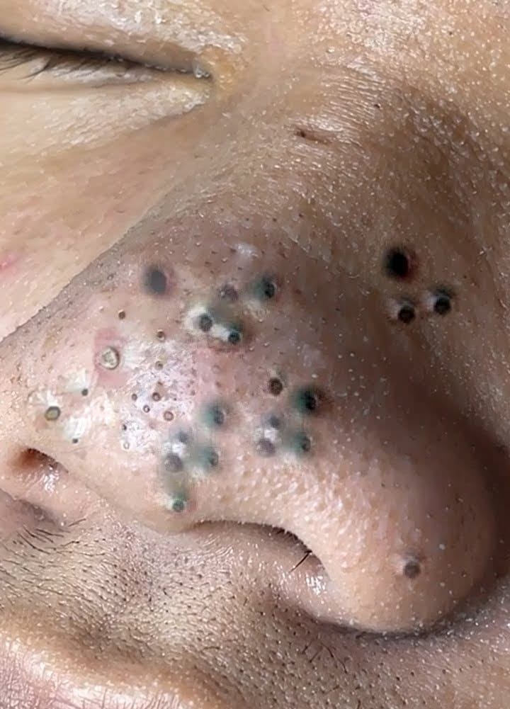 The Day After Tomorrow